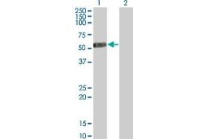 Western Blot analysis of IL13RA2 expression in transfected 293T cell line by IL13RA2 monoclonal antibody (M01), clone 2E10.
