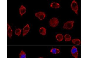 Confocal immunofluorescence analysis of L929 cells using DAO Polyclonal Antibody at dilution of 1:100. (D Amino Acid Oxidase antibody)