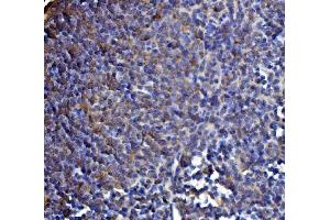 IHC analysis of DLST using anti-DLST antibody (ABIN7599412). (DLST antibody  (AA 1-453))