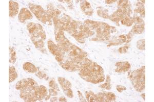 Immunohistochemistry (IHC) image for anti-Catechol-O-Methyltransferase (COMT) (AA 221-271) antibody (ABIN7454936)