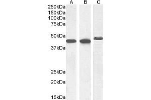 (ABIN185271) (1 μg/mL) staining of Human Heart (A), (0. (Smooth Muscle Actin antibody  (N-Term))