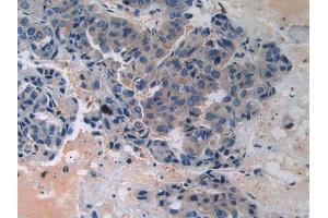 Immunohistochemistry (IHC) image for anti-Adrenergic, Beta, Receptor Kinase 1 (ADRBK1) (AA 398-640) antibody (ABIN7440779)