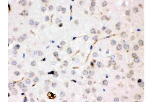 IHC analysis of Ceruloplasmin/CP using anti-Ceruloplasmin/CP antibody (ABIN3044508).
