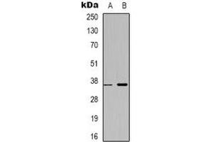 Western blot analysis of ZNF265 expression in HepG2 (A), MCF7 (B) whole cell lysates. (ZNF265 antibody)