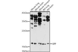 Western blot analysis of extracts of various cell lines, using GRP antibody (ABIN6127573, ABIN6141433, ABIN6141434 and ABIN6222002) at 1:1000 dilution.