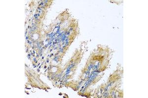 Immunohistochemistry of paraffin-embedded human trachea using COX6B1 antibody at dilution of 1:100 (x40 lens).