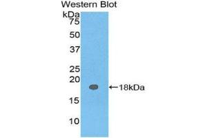 Western Blotting (WB) image for anti-Carcinoembryonic Antigen Gene Family (CEA) (AA 93-221) antibody (ABIN1077898)