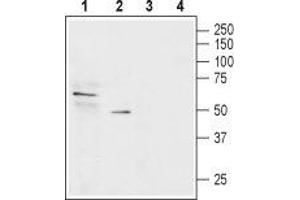 Solute Carrier Family 22 (Organic Cation Transporter), Member 1 (SLC22A1) peptide
