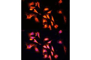 LAMTOR1 antibody  (AA 1-161)
