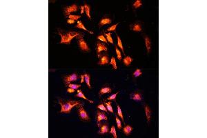 Immunofluorescence analysis of U-2 OS cells using L Polyclonal Antibody (ABIN6133274, ABIN6143083, ABIN6143084 and ABIN6215309) at dilution of 1:100 (40x lens).