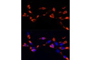 Immunofluorescence analysis of NIH/3T3 cells using MCTS1 antibody (ABIN6132341, ABIN6143657, ABIN6143658 and ABIN6224877) at dilution of 1:100 (40x lens). (MCTS1 antibody  (AA 1-181))