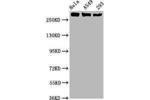 Western Blot Positive WB detected in Hela whole cell lysate,A549 whole cell lysate,293 whole cell lysate All lanes Phospho-POLR2A antibody at 1. (Recombinant POLR2A/RPB1 antibody  (pSer2))