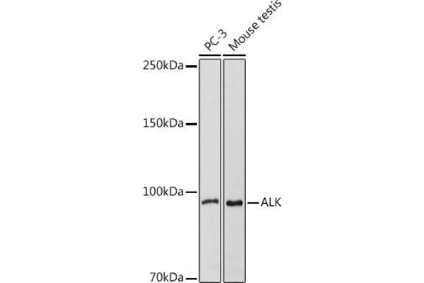 ALK 抗体  (AA 19-300)