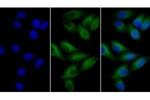 Detection of TUBb in Human MCF7 cell using Anti-Tubulin Beta (TUBb) Monoclonal Antibody (TUBB antibody  (AA 170-419))