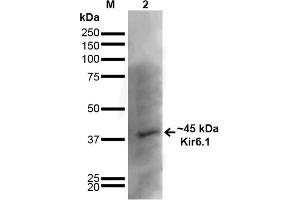 Western Blot analysis of Rat Brain showing detection of ~45 kDa Kir6. (KCNJ8 antibody  (AA 306-424) (APC))