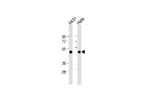 All lanes : Anti-RAD9 Antibody (BH3 Domain Specific) at 1:4000 dilution Lane 1: A431 whole cell lysate Lane 2: Hela whole cell lysate Lysates/proteins at 20 μg per lane. (RAD9A antibody  (AA 1-30))