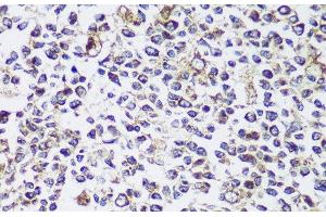 Immunohistochemistry of paraffin-embedded Human tonsil using ECH1 Polyclonal Antibody at dilution of 1:150 (40x lens).