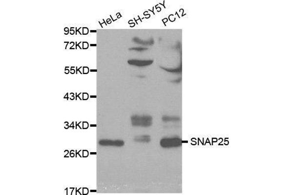 SNAP25 antibody  (AA 1-206)