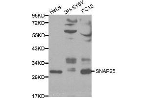 Western blot analysis of extracts of various cell lines, using SNAP25 antibody. (SNAP25 antibody  (AA 1-206))