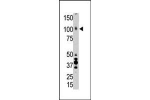 The LRP8 polyclonal antibody  is used in Western blot to detect LRP8 in placenta tissue lysate.