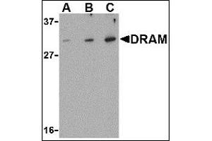 Image no. 2 for anti-DNA-Damage Regulated Autophagy Modulator 1 (DRAM1) (N-Term) antibody (ABIN372925) (DRAM antibody  (N-Term))