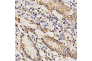 Immunohistochemistry (IHC) image for anti-TAP Binding Protein (Tapasin) (TAPBP) antibody (ABIN1875423) (TAPBP antibody)
