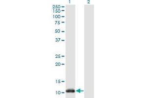 Western Blotting (WB) image for anti-NADH Dehydrogenase (Ubiquinone) 1 alpha Subcomplex, 5, 13kDa (NDUFA5) (AA 1-116) antibody (ABIN948173)