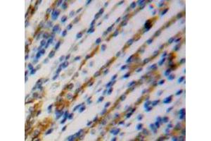 Used in DAB staining on fromalin fixed paraffin- embedded kidney tissue (SPRY2 antibody  (AA 116-305))
