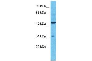 Host:  Rabbit  Target Name:  KCNK4  Sample Type:  Colorectal Tumor lysates  Antibody Dilution:  1. (KCNK4 antibody  (N-Term))