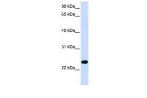 Image no. 1 for anti-Paired Immunoglobin-Like Type 2 Receptor beta (PILRB) (AA 146-195) antibody (ABIN6738290) (PILRB antibody  (AA 146-195))