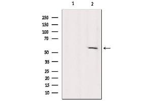 Western blot analysis of extracts from Sp2/0, using KIF12 Antibody.