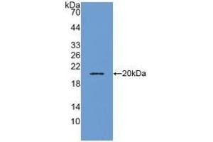 Detection of Recombinant ADM, Human using Polyclonal Antibody to Adrenomedullin (ADM) (Adrenomedullin antibody  (AA 22-147))