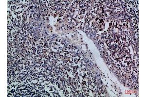 Immunohistochemical analysis of paraffin-embedded Human-tonsil, antibody was diluted at 1:100 (GZMM antibody  (AA 207-256))