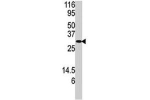 Western blot analysis of DUSP3 polyclonal antibody  in SK-BR-3 cell lysate. (Dual Specificity Phosphatase 3 (DUSP3) (N-Term) antibody)