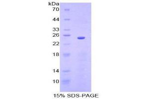 SDS-PAGE (SDS) image for Sprouty Homolog 3 (SPRY3) (AA 91-288) protein (His tag) (ABIN2126837)