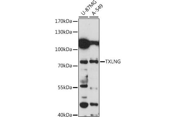 Taxilin gamma (TXLNG) (AA 1-140) antibody
