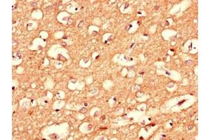 Immunohistochemistry of paraffin-embedded human brain tissue using ABIN7148421 at dilution of 1:100 (Complexin 1 antibody  (AA 1-134))