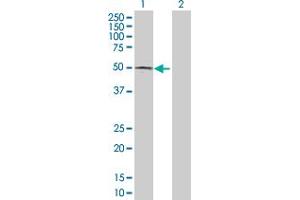 Western Blot analysis of ACP6 expression in transfected 293T cell line by ACP6 MaxPab polyclonal antibody. (ACP6 antibody  (AA 1-428))
