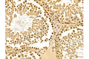 ABIN6262398 and ABIN6269012 at 1/100 staining Rat testis tissue by IHC-P. (HSP70 antibody  (C-Term))
