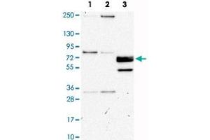Western Blot analysis of Lane 1: RT-4, Lane 2: U-251MG sp and Lane 3: human plasma (IgG/HSA depleted) with CUX1 polyclonal antibody .
