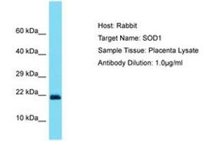 Image no. 1 for anti-Superoxide Dismutase 1, Soluble (SOD1) (C-Term) antibody (ABIN6750454) (SOD1 antibody  (C-Term))