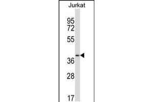 Western blot analysis in Jurkat cell line lysates (35ug/lane). (PAQR6 antibody  (C-Term))