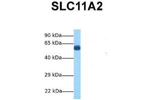 Host:  Rabbit  Target Name:  SLC11A2  Sample Tissue:  Human Fetal Lung  Antibody Dilution:  1.