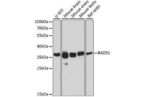 Western blot analysis of extracts of various cell lines, using RAD51 antibody. (RAD51 antibody  (AA 50-150))