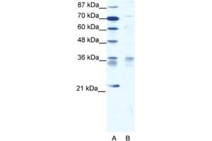 Western Blotting (WB) image for anti-BARX Homeobox 1 (BARX1) antibody (ABIN2460616)