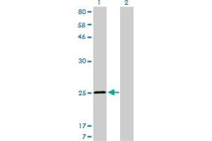 Western Blot analysis of TNNI3 expression in transfected 293T cell line by TNNI3 monoclonal antibody (M04), clone 1E7.