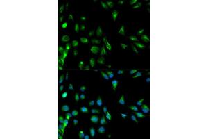 Immunofluorescence analysis of HeLa cell using RASSF1 antibody. (RASSF1 antibody  (AA 101-340))
