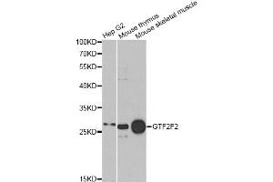 Western blot analysis of extracts of various cell lines, using GTF2F2 antibody. (GTF2F2 antibody)