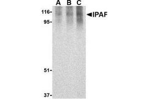 Western blot analysis of Ipaf in human PBL lysate with AP30437PU-N Ipaf antibody at 0. (NLRC4 antibody)