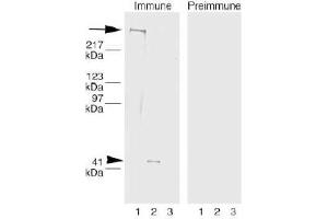 Image no. 1 for anti-Collagen, Type VII, alpha 1 (COL7A1) (AA 479-578), (AA 757-967), (AA 97-200) antibody (ABIN191494) (COL7A1 antibody  (AA 97-200, AA 479-578, AA 757-967))